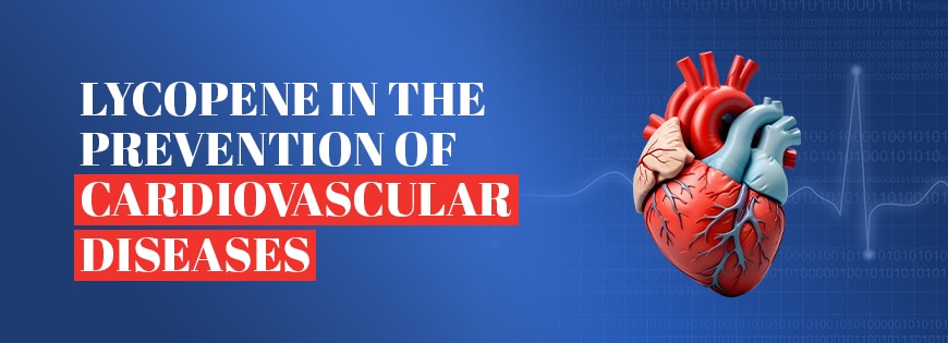 Lycopene in the Prevention of Cardiovascular Diseases 