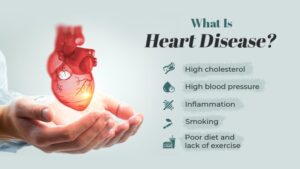 What Is Heart Disease